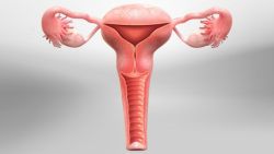 9 lý do cần phẫu thuật cắt tử cung