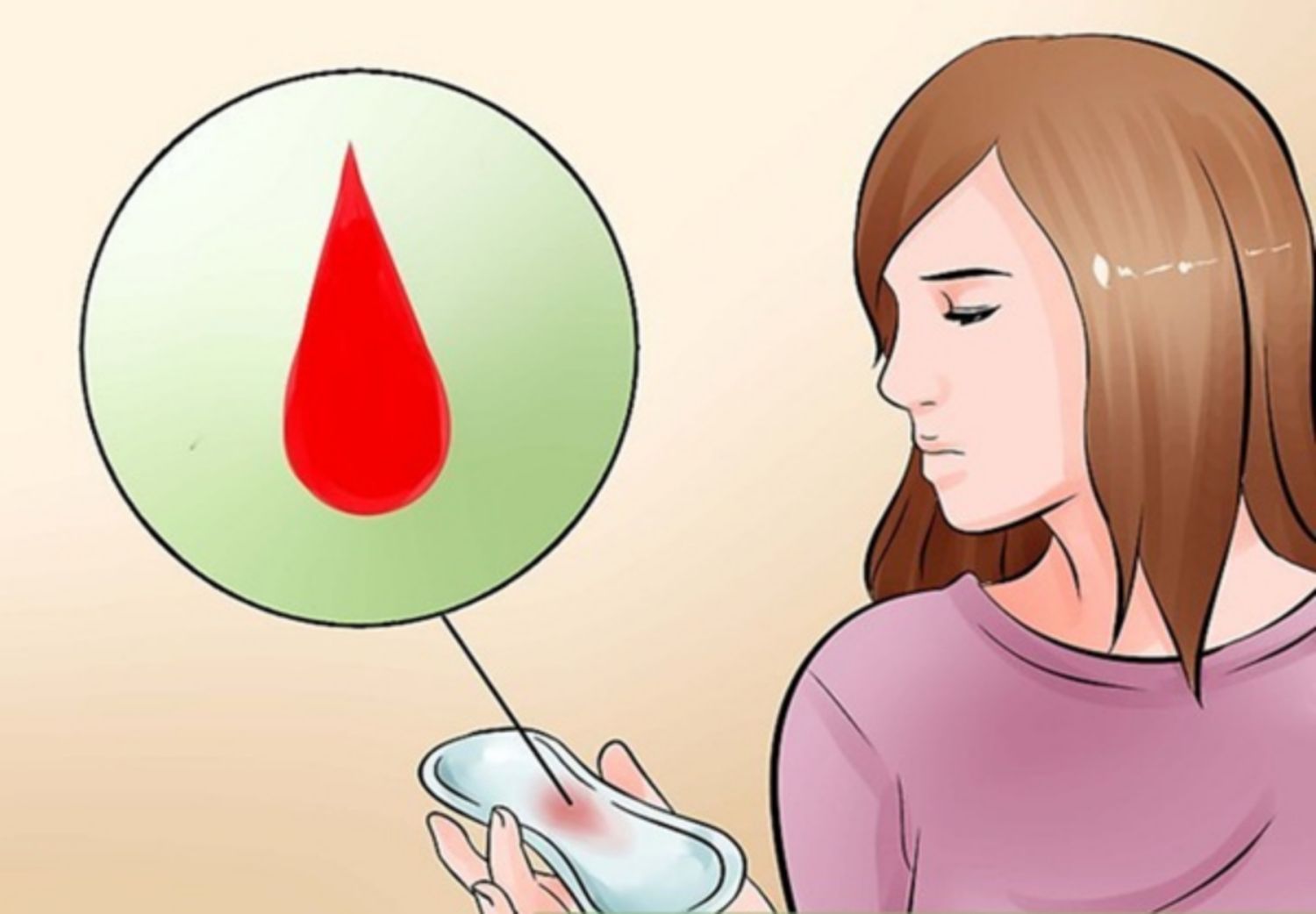 Chảy máu có phải triệu chứng nhiễm nấm âm đạo?