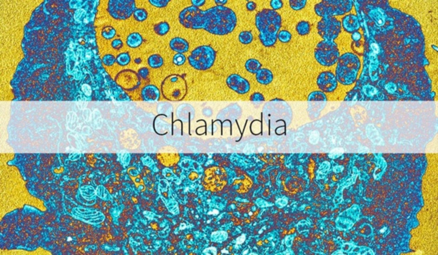 Sau bao lâu thì chlamydia biểu hiện triệu chứng?