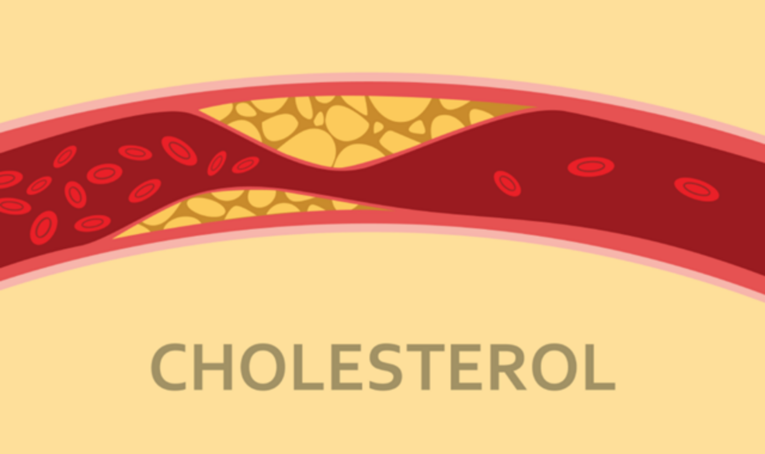 Mối liên hệ giữa cholesterol cao và rối loạn cương dương