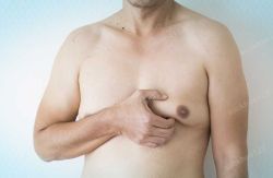 Testosterone thấp và chứng vú to ở nam giới