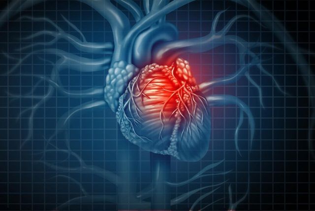 Bệnh cơ tim là gì?
