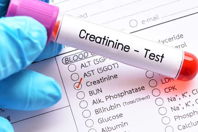 Quy trình xét nghiệm creatinin máu như thế nào và cần chuẩn bị gì trước khi thực hiện xét nghiệm này?
