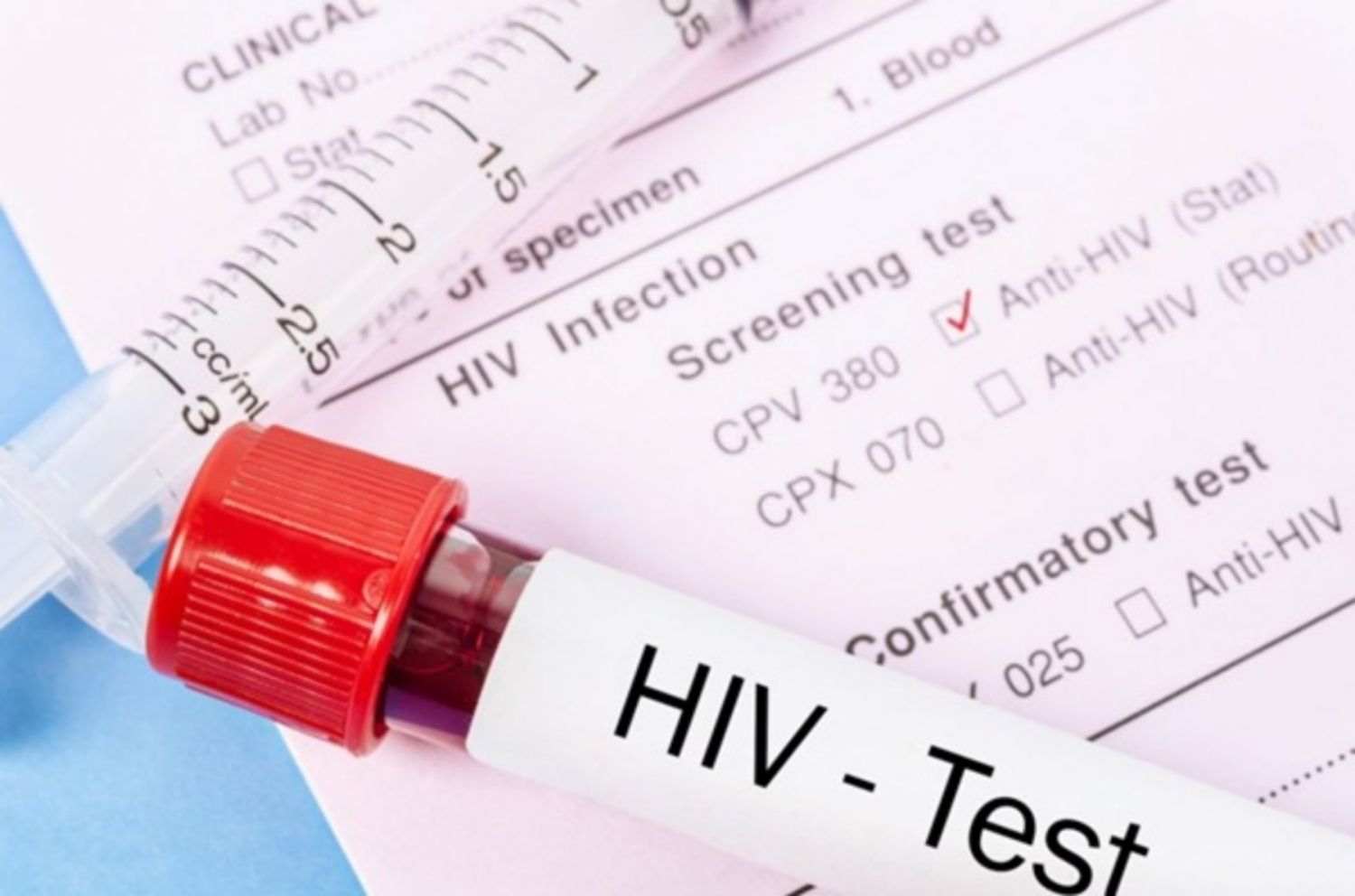Thế nào là dương tính giả với HIV?