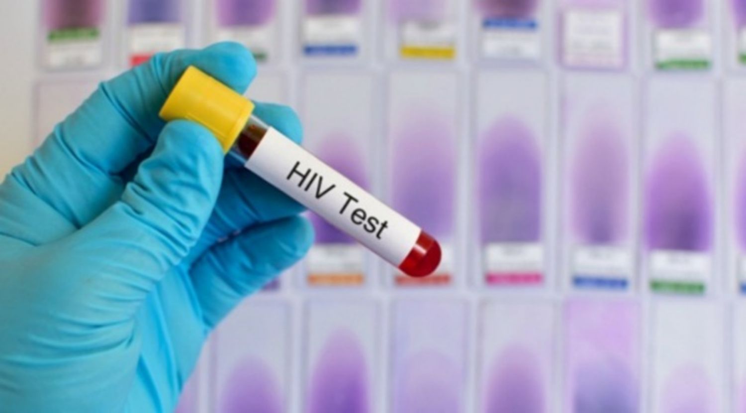HIV test