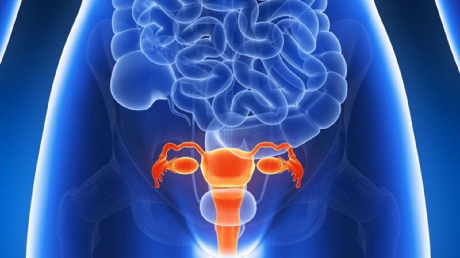 Lạc nội mạc tử cung ở cổ tử cung: Triệu chứng, chẩn đoán và cách điều trị
