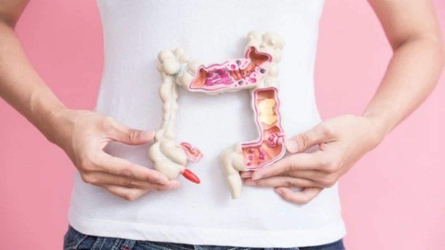 Lạc nội mạc tử cung ở ruột điều trị bằng cách nào?