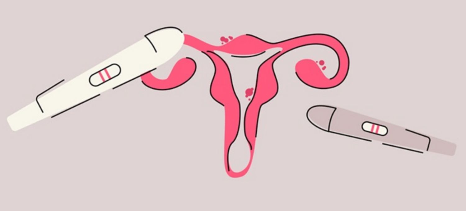 Có thể mang thai khi bị lạc nội mạc tử cung không?