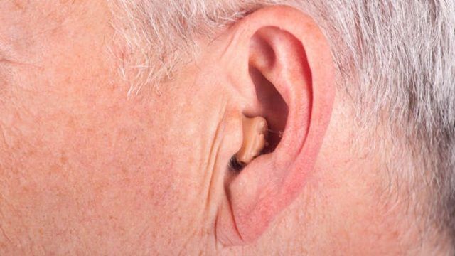 Nếp gấp dái tai có thể là dấu hiệu cảnh báo bệnh tim mạch