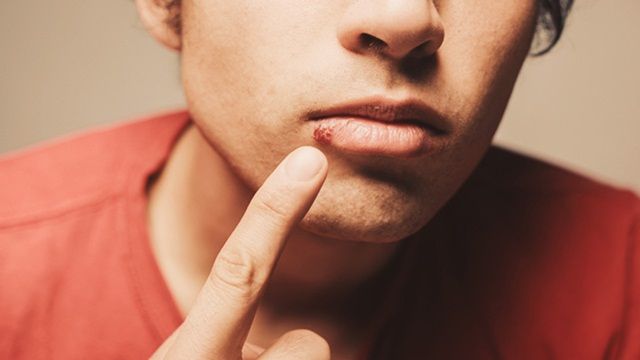 Các bệnh lây truyền qua quan hệ tình dục bằng miệng