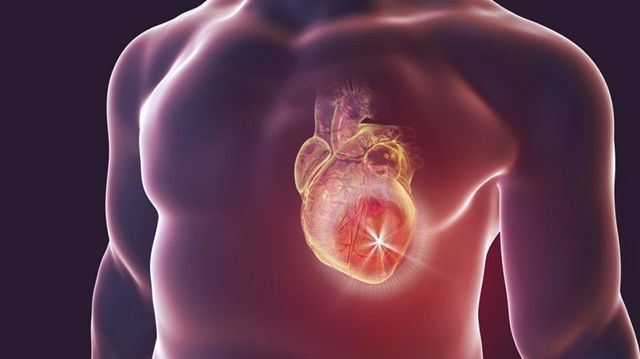 Suy tim sung huyết là gì và điều trị ra sao?