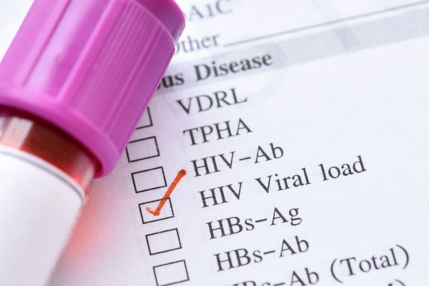 Mối liên hệ giữa tải lượng virus và nguy cơ lây truyền HIV