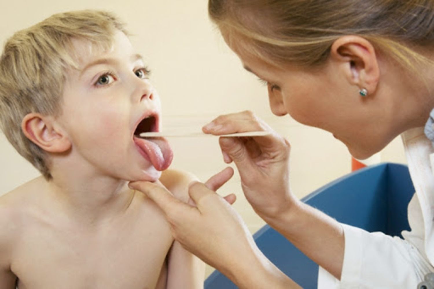 Tăng bạch cầu đơn nhân ở trẻ (Mononucleosis –  bệnh do những nụ hôn)