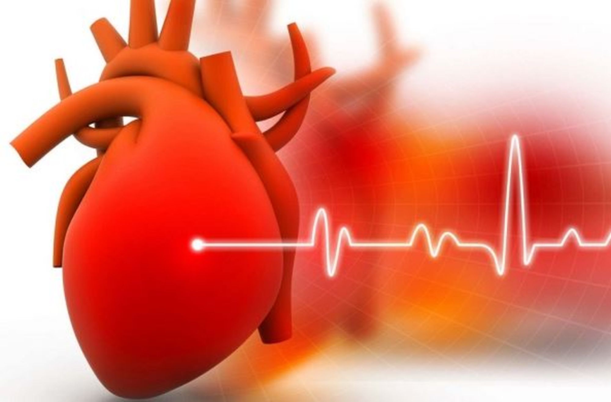 Người bị rối loạn nhịp tim cần làm gì?