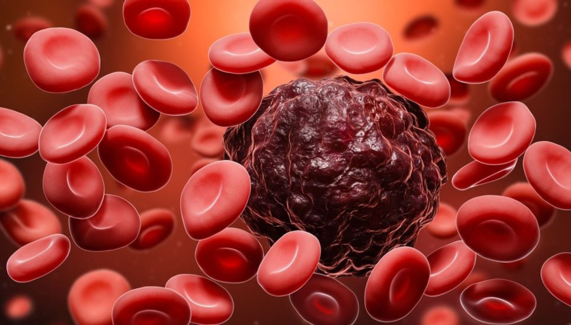 Ung thư máu sống được bao lâu?