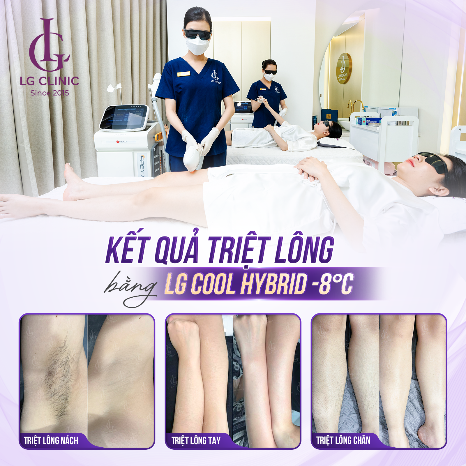 Công nghệ LG Cool Hybrid –8°C là giải pháp triệt lông hiệu quả cho mọi vùng da trên cơ thể