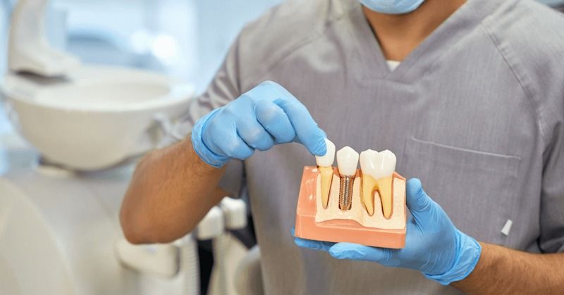 Không ít người xem nhẹ hoặc bỏ qua việc hỏi rõ về chế độ bảo hành 