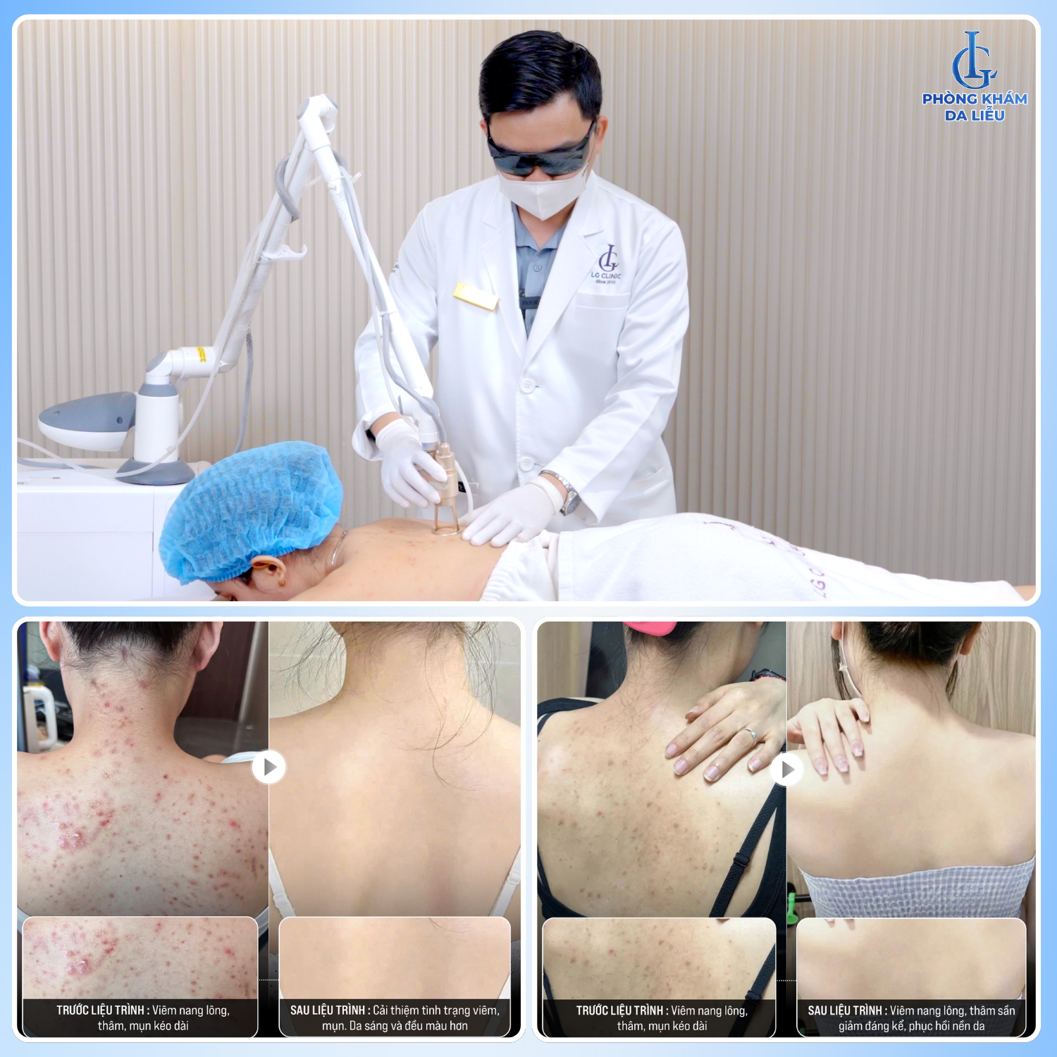 Nhiều khách hàng chia sẻ kết quả ngoài mong đợi sau khi điều trị tại Phòng khám Da liễu LG
